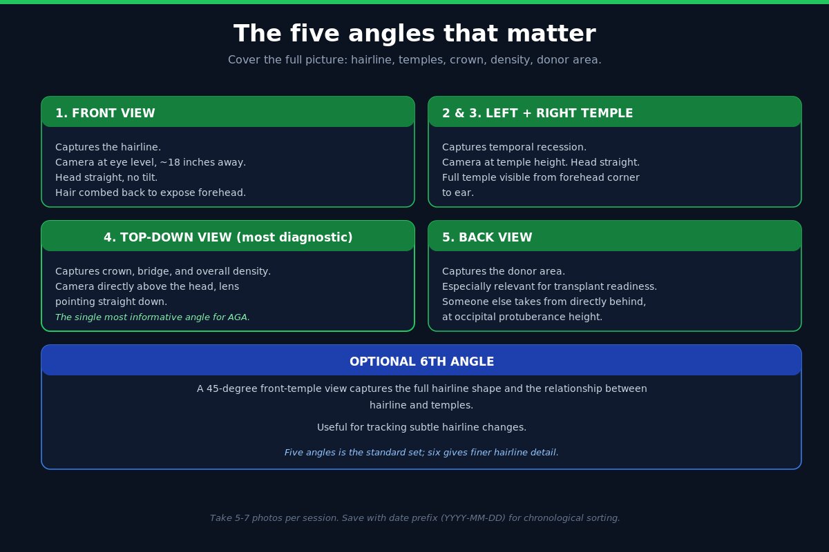 Five hair tracking photo angles - front, sides, top-down, back