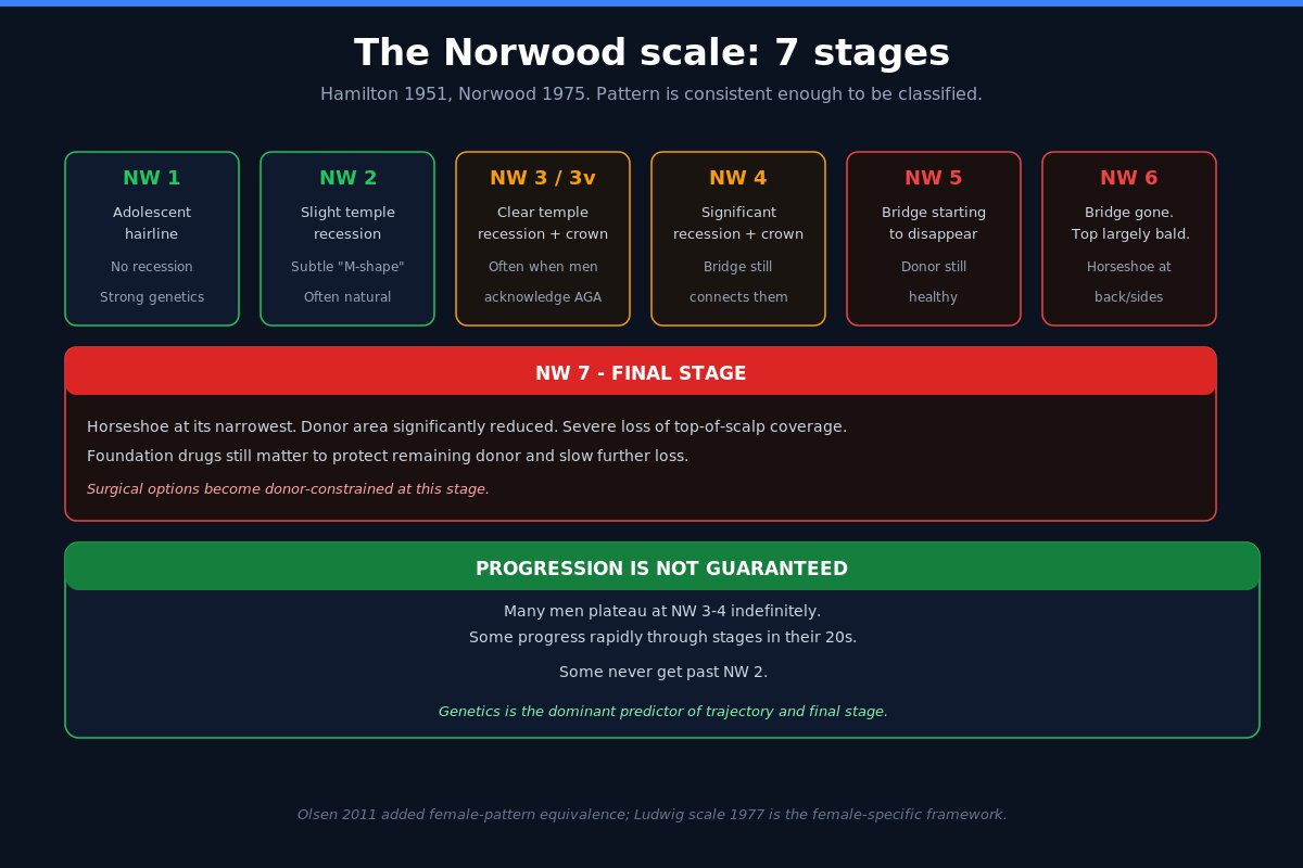 Norwood scale 7 stages of male pattern hair loss